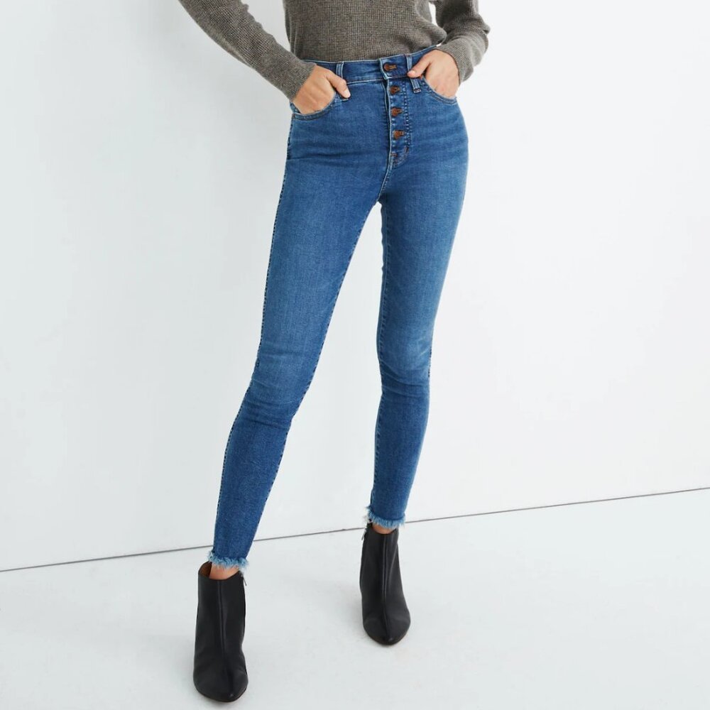 Madewell Button Front Fly 10' High Rise Skinny Jeans